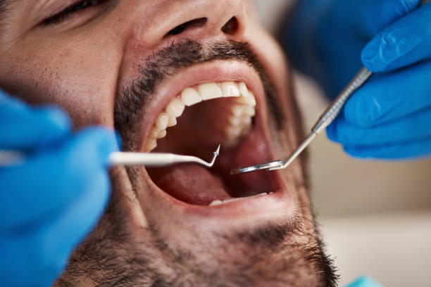 Best Tooth Infection Emergency Dentist  in Kingston, IL